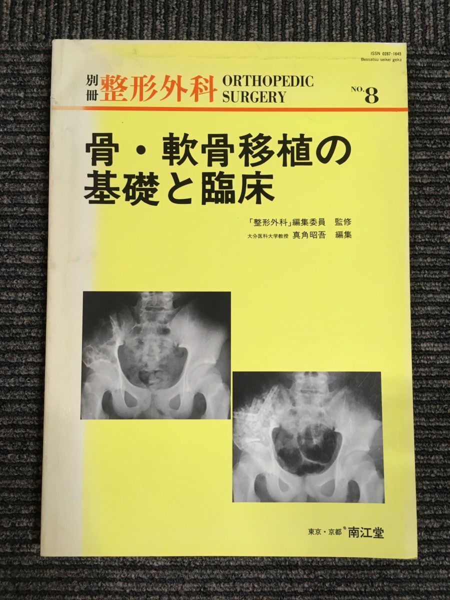 　骨・軟骨移植の基礎と臨床 (別冊整形外科 (No.8))_画像1