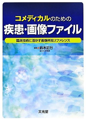 コメディカルのための疾患・画像ファイル 臨床技術に活かす画像所見リファレンス／鈴木正行【編】_画像1