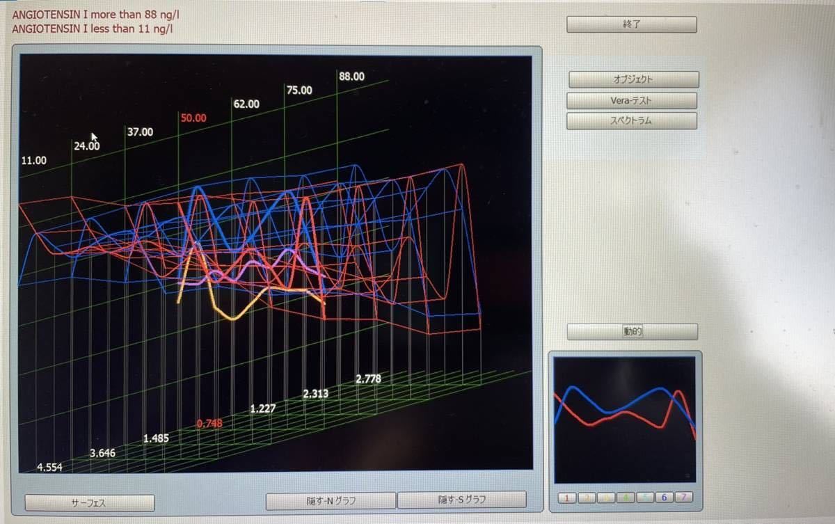  wave moving measuring instrument wave moving water Vaio resonance quantum en Toro pi- new scan reference commodity 