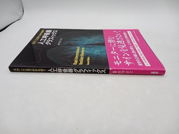 え!?ここまでわかるの?人工呼吸器グラフィックス 竹内宗之 メディカル・サイエンス・インターナショナル 店舗受取可_画像2