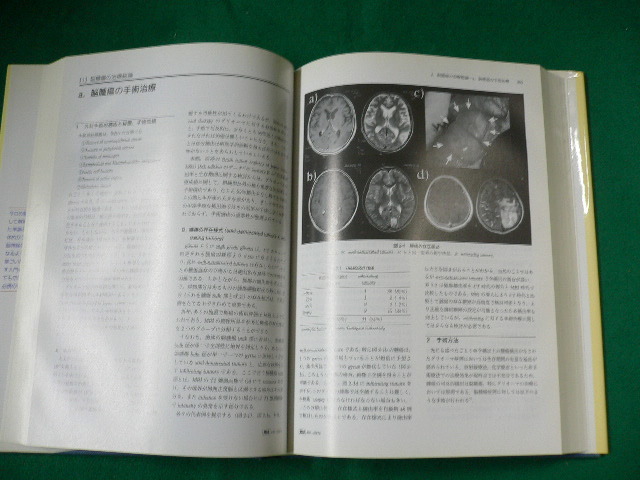 ■脳神経外科臨床指針　橋本信夫　中外医学社　2002年初版　大型本■FAUB2019101407■_画像3