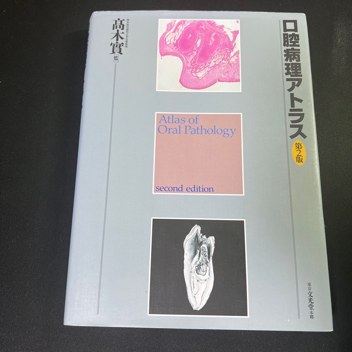 口腔病理アトラス (第2版) 高木実/監 山本浩嗣/編 坂井英隆/編 高田隆/編