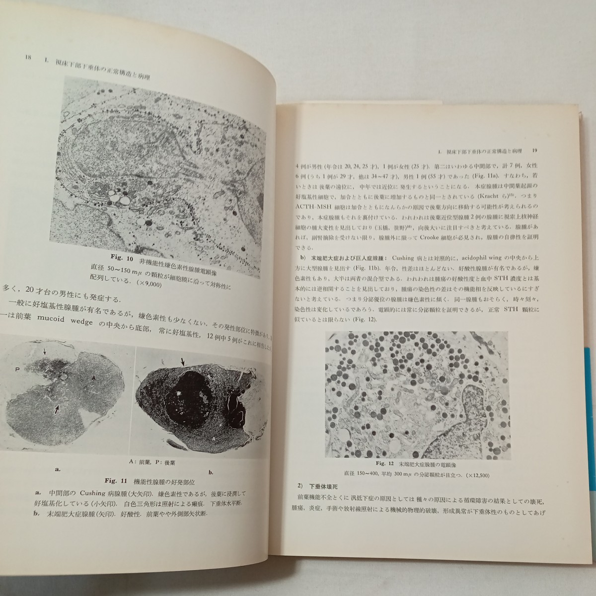 zaa-429♪内科シリーズNO.24『下垂体疾患のすべて』　鎮目和夫(編)　南江堂（1976/12/1発売）