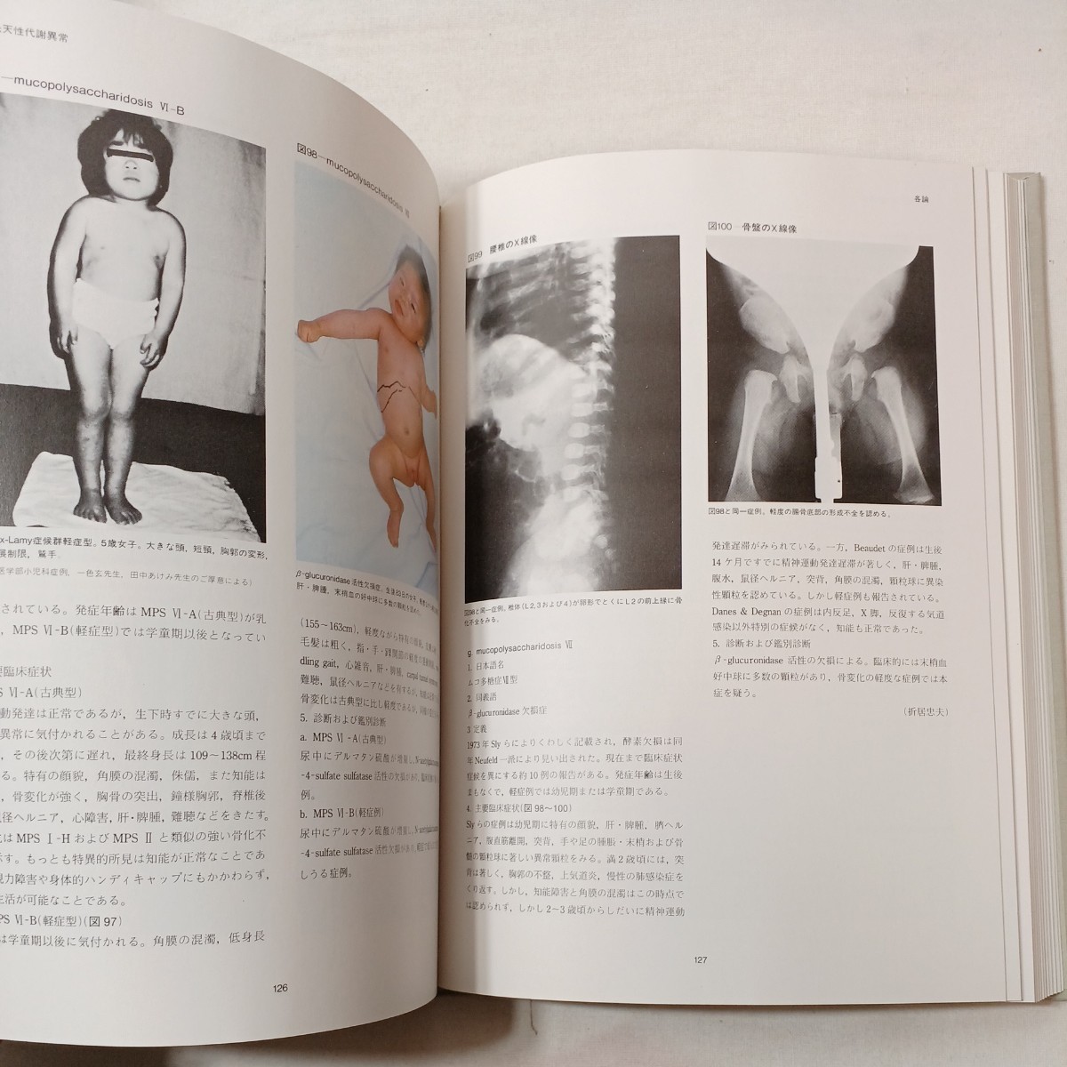 zaa-431♪図説臨床小児科講座5 『 先天性代謝異常・染色体異常・奇形』小林登 (ほか編集委員)(1984/02発売)メジカルビュー社 - 医学一般 zaa-431♪図説臨床小児科講座5 『 先天性代謝異常・染色体異常・奇形』小林登 (ほか編集委員)(1984/02発売)メジカルビュー社 - 医学一般