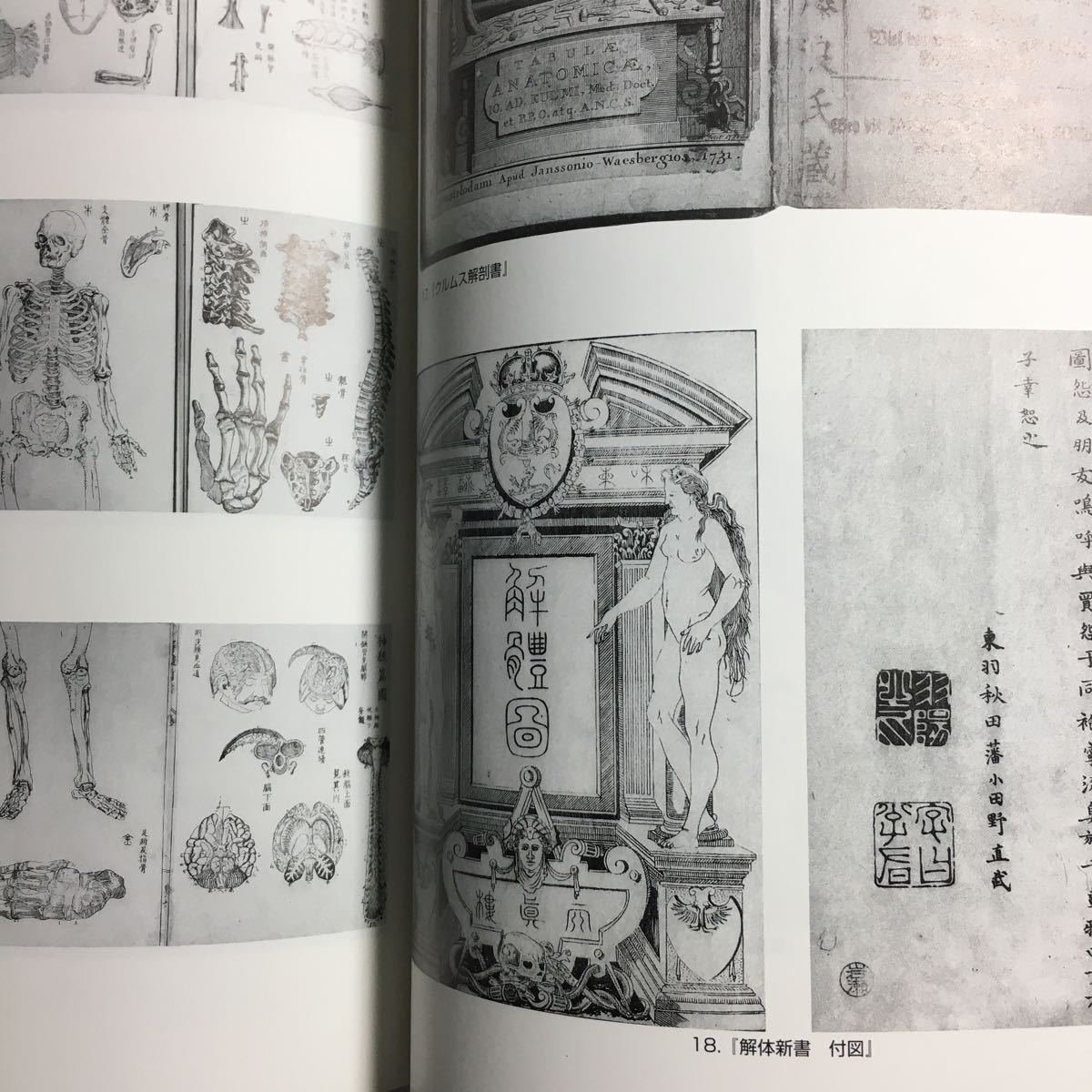 【送料無料】西洋医学事始 治療と養生の世界 図録 * 解体新書 はしか絵 疱瘡絵 歌川国芳 解剖図 山脇東洋 杉田玄白 華岡青洲 江戸時代_画像4