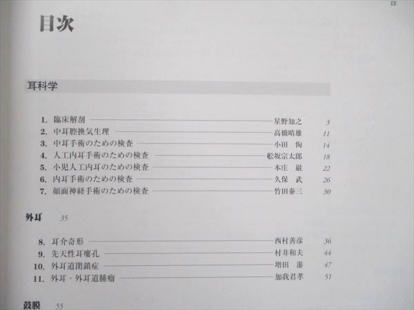 UA90-016 医学書院 耳鼻咽喉・頭頸部手術アトラス 上巻 1999 小松崎篤 35R3D_画像6