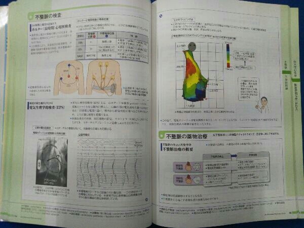 病気がみえる 循環器 第4版(vol.2) 医療情報科学研究所_画像6