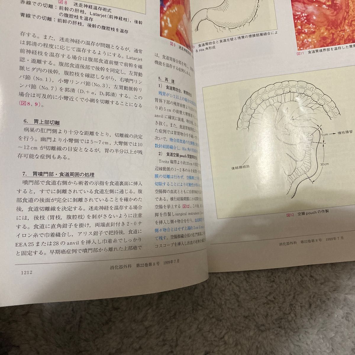 アトラスでみる胃癌の手術　消化器内視鏡用語集　第3版　(2冊)