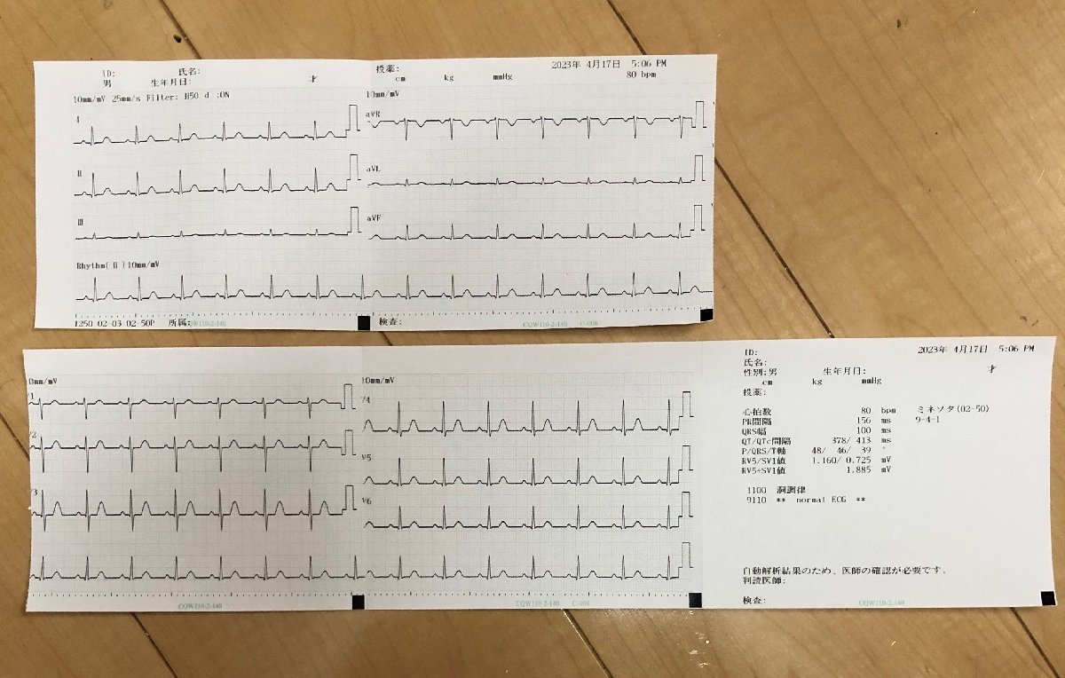 日本光電 心電計 小型 動作確認済み(詳細は商品説明参照) バッテリー動作 12誘導 医療用 印刷可 付属品一式 医師 動物 病院 検査技師 診療_画像6