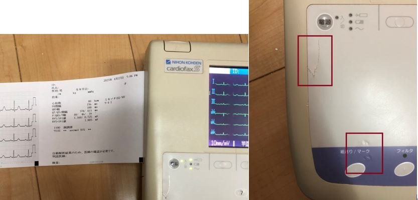 日本光電 心電計 小型 動作確認済み(詳細は商品説明参照) バッテリー動作 12誘導 医療用 印刷可 付属品一式 医師 動物 病院 検査技師 診療_画像9