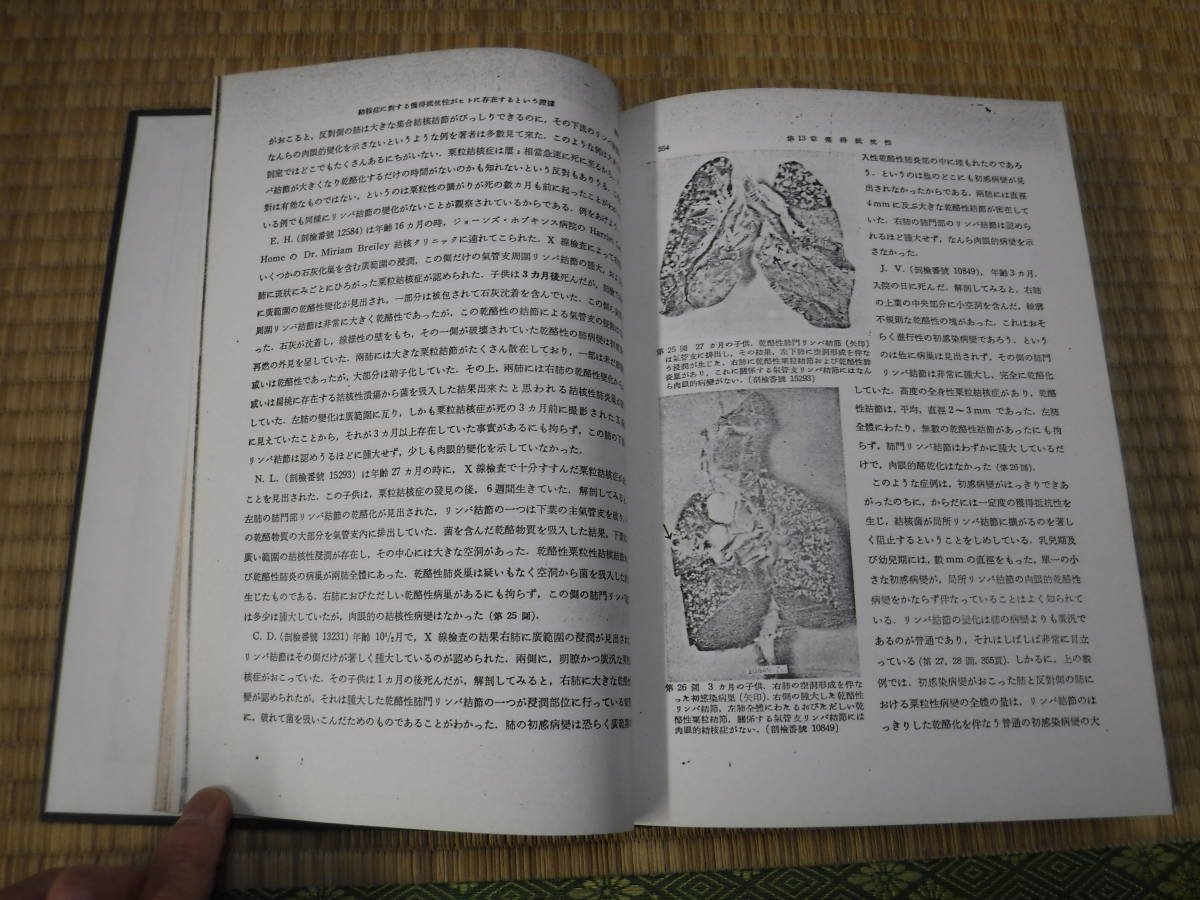 リッチ著　結核の病理発生論（上1，2、下1，2，3）5冊　複製本　岩波書店_画像8