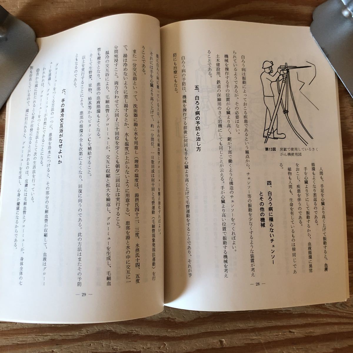 K11C1-230411 レア［白ろう病の原因と予防と解決法 新しい健康時代の夜明け 井上静雄］血液の循環理論 グローミューと毛細管_画像6