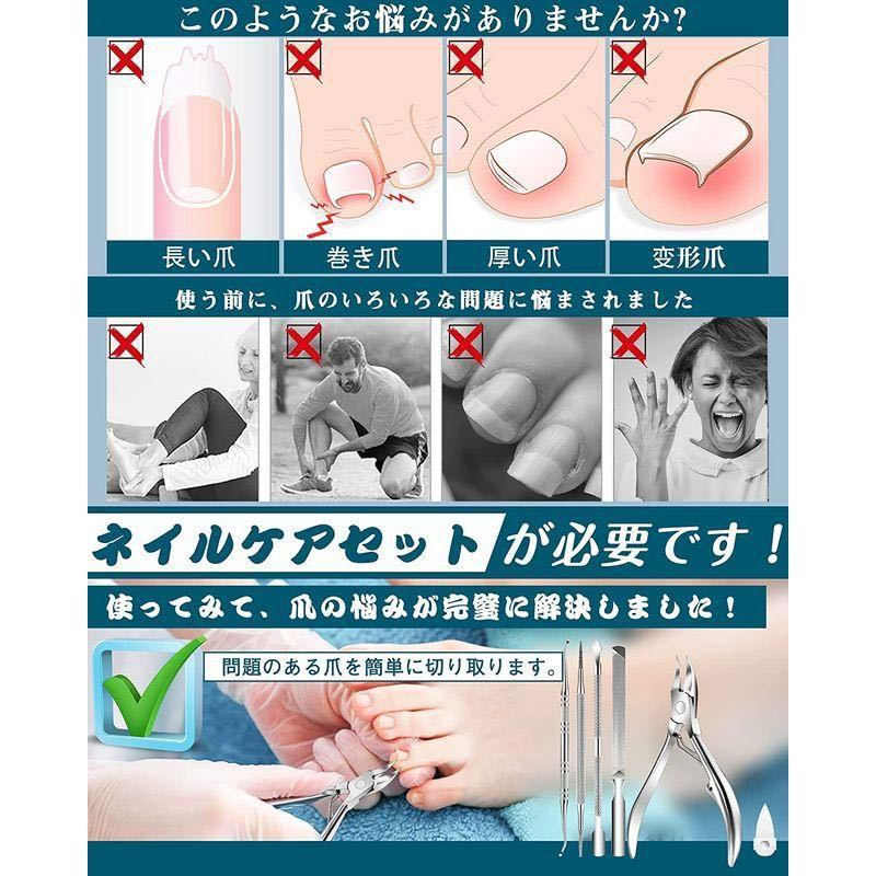 日本全国 送料無料 貝印 KAI ニッパー爪切り ツメキリ 男女兼用 手 足 フット 巻き爪 に