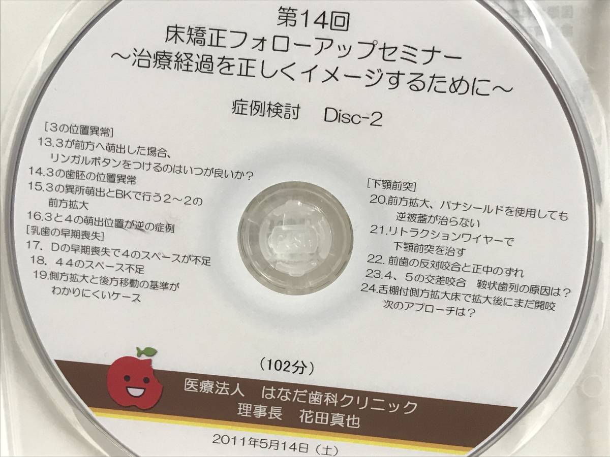 第14回 床矯正フォローアップセミナー】DVD☆症例検討 前歯部の 第14回 床矯正フォローアップセミナー】DVD☆症例検討 前歯部の