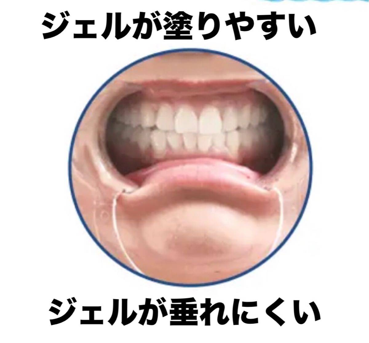1本価格】人気の高品質ジェル 歯科ジェル 開口器マウス 1本価格】人気の高品質ジェル 歯科ジェル 開口器マウス