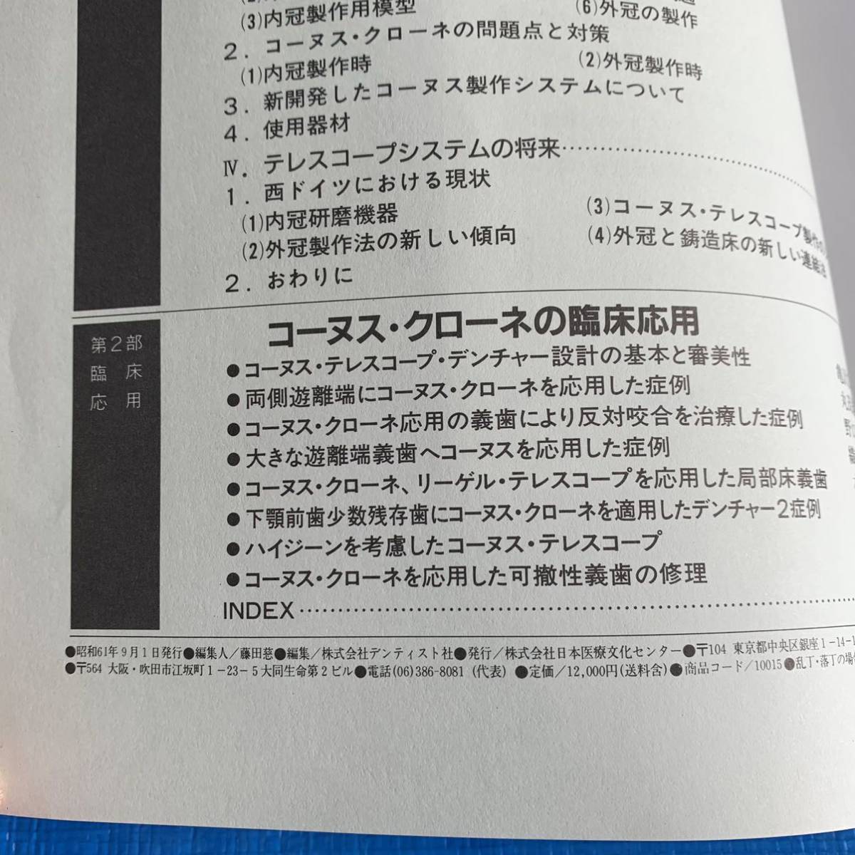 正統派コーヌス・クローネ 「基礎と臨床」/稲葉繁/テレスコープ・クラウン/デンチャー/義歯/応用/歯科医/教科書/デンタルヒントの画像8