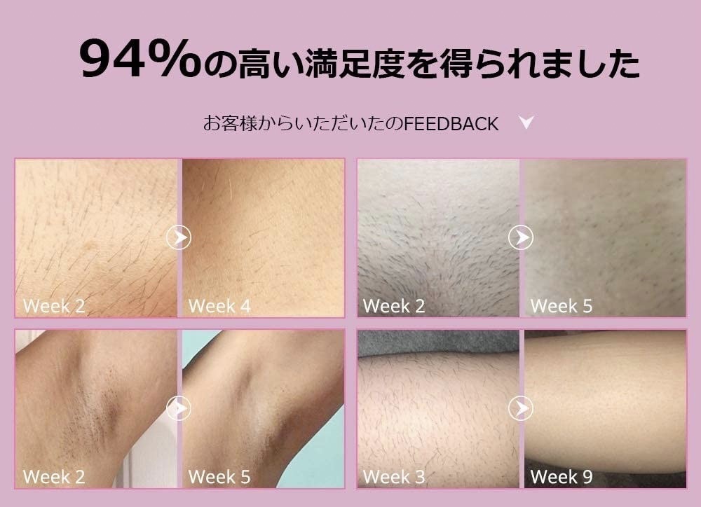 ☆お肌への負担が圧倒的に少なく敏感肌でも安心安全に使える♪☆IPL光