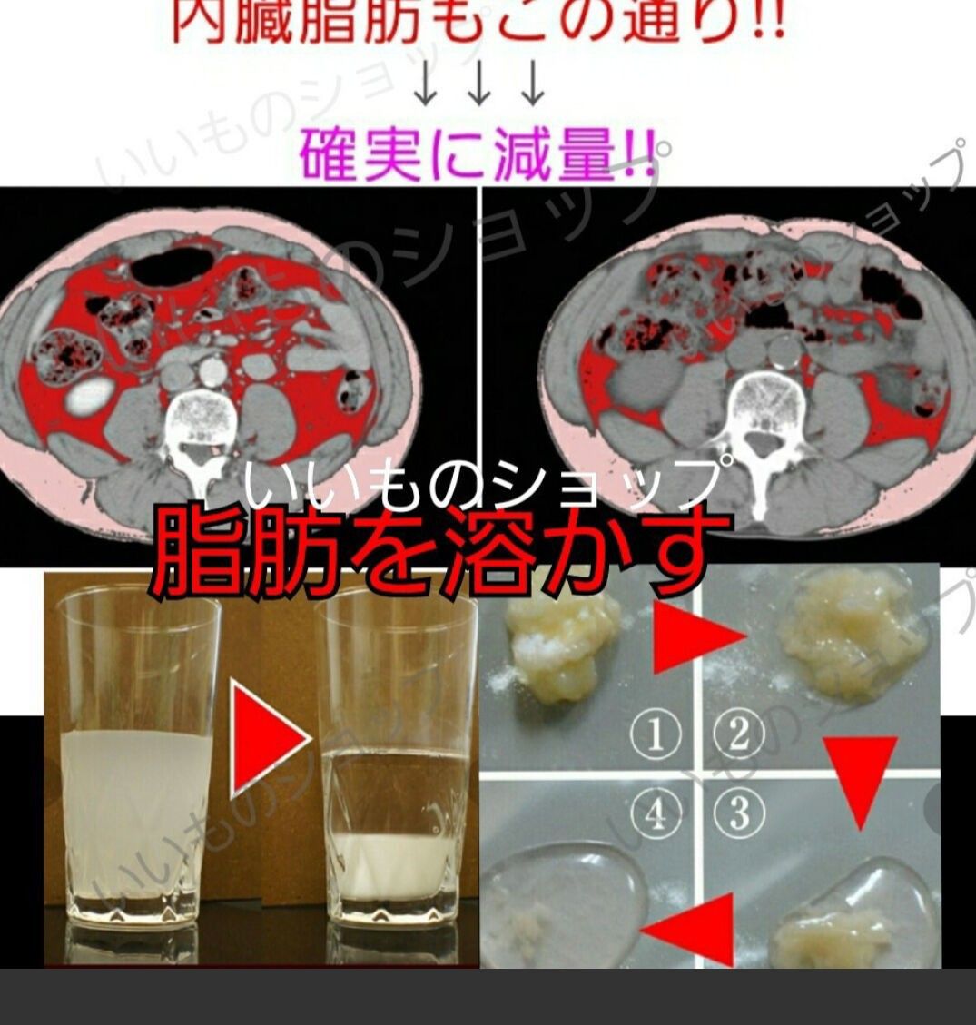 500円引きクーポン】 強力 燃焼系ダイエット サプリメント 2袋 L