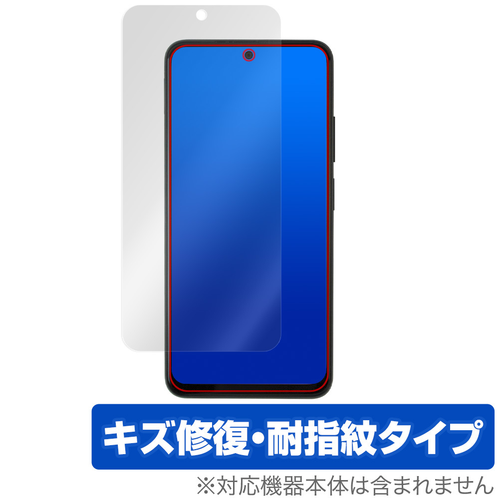 Xiaomi Redmi Note 11S / 11 保護 フィルム OverLay Magic シャオミー スマホ レドミ ノート 液晶保護 傷修復 耐指紋 指紋防止_画像1