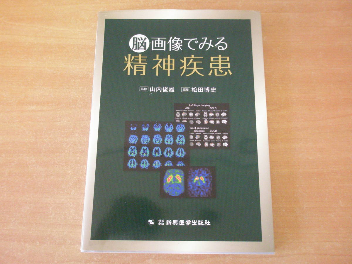 上等な 脳画像でみる精神疾患 □新興医学出版社□ 医学一般