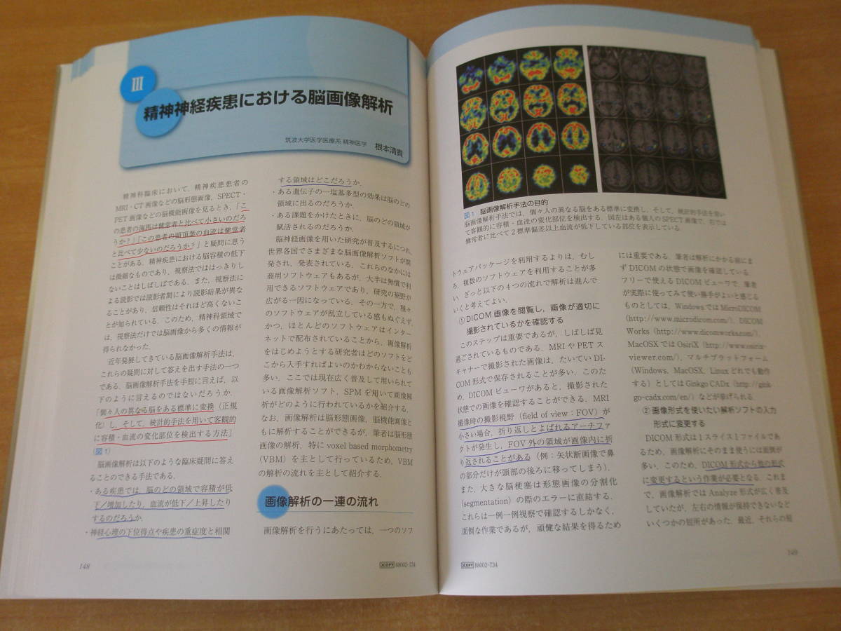 脳画像でみる精神疾患　■新興医学出版社■