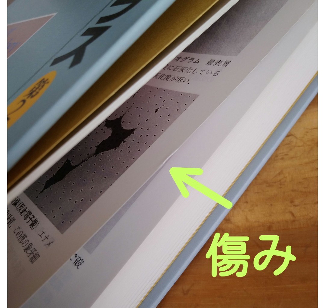 口腔病理アトラス (第2版) 高木実/監 山本浩嗣/編 坂井英隆/編
