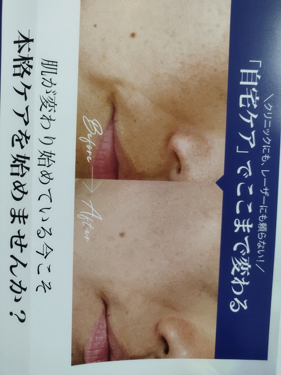 GW限定】美白 ビーグレン お試し 7 day Special Set プログラム1 GW限定】美白 ビーグレン お試し 7 day Special Set プログラム1