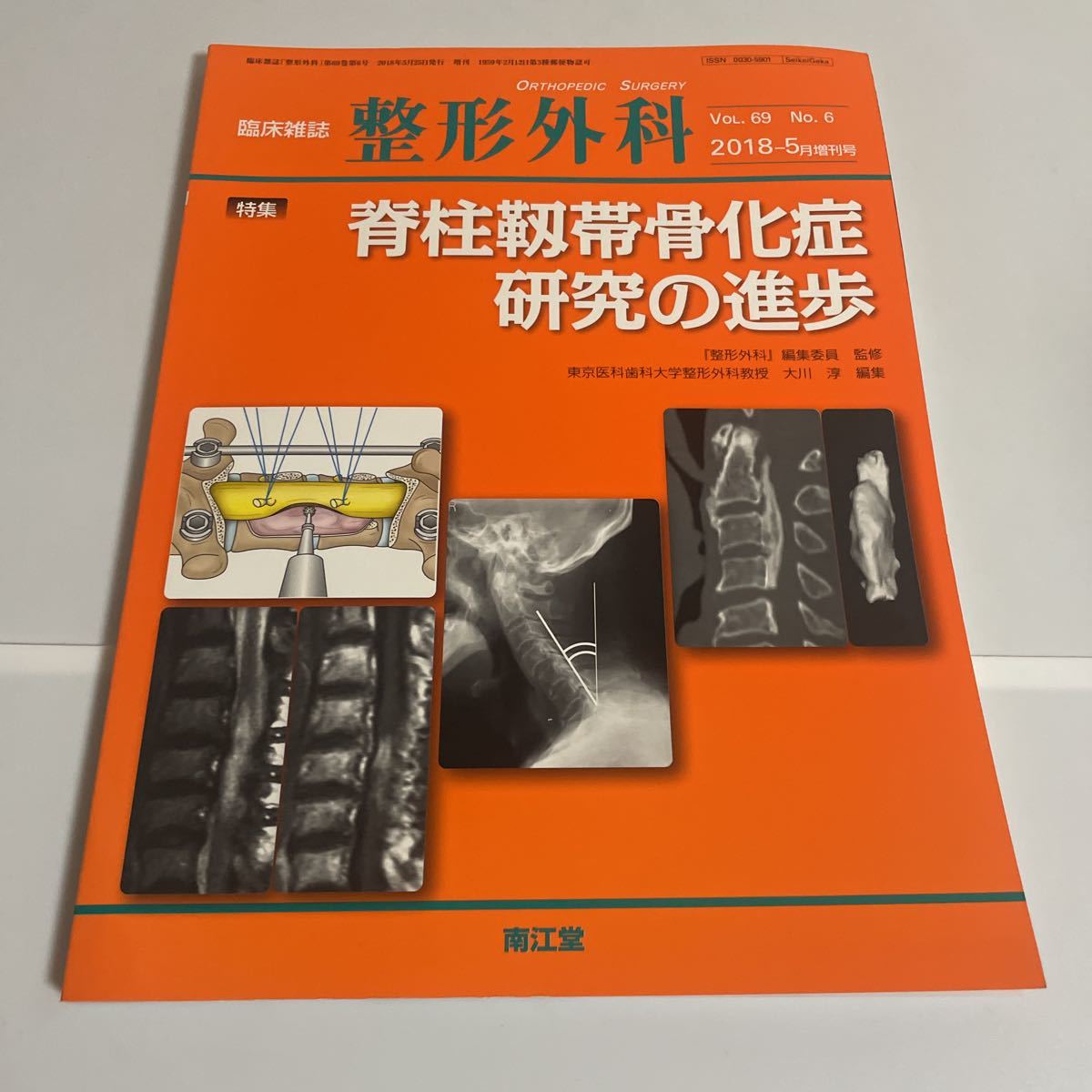 ヤフオク! - 臨床雑誌 整形外科 特集 脊柱靱帯骨化症研究の進歩 vol...