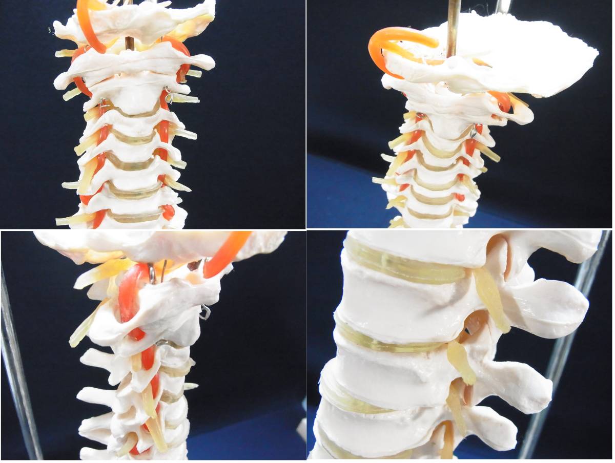 ▲骨格標本 脊髄模型 脊髄骨盤模型 スタンド付き 脊髄 骨盤 股関節 脊髄神経根 椎間板 吊り下げ式 骨 人体模型 骨格模型 実物大 医療▲160_画像6