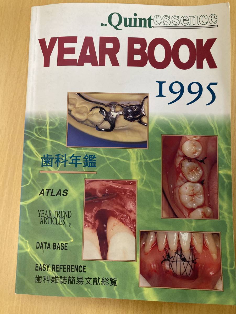 IZ0499 別冊 ザ・クインテッセンスYEARBOOK’95 1995年8月10日発行 歯科年鑑 歯科雑誌 簡易文献総覧 バイオメカニクス　　　　　　　　　　_画像1