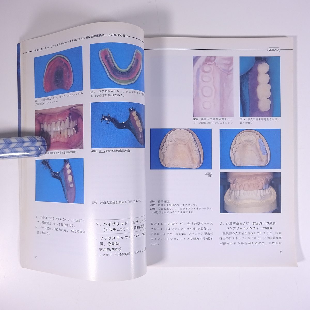 QDT別冊 エステニア アートグラス タルギス の技工操作 クインテッセンス出版 1997 大型本 歯科学 歯医者 歯科衛生士 歯科技工士 デンタル_画像8
