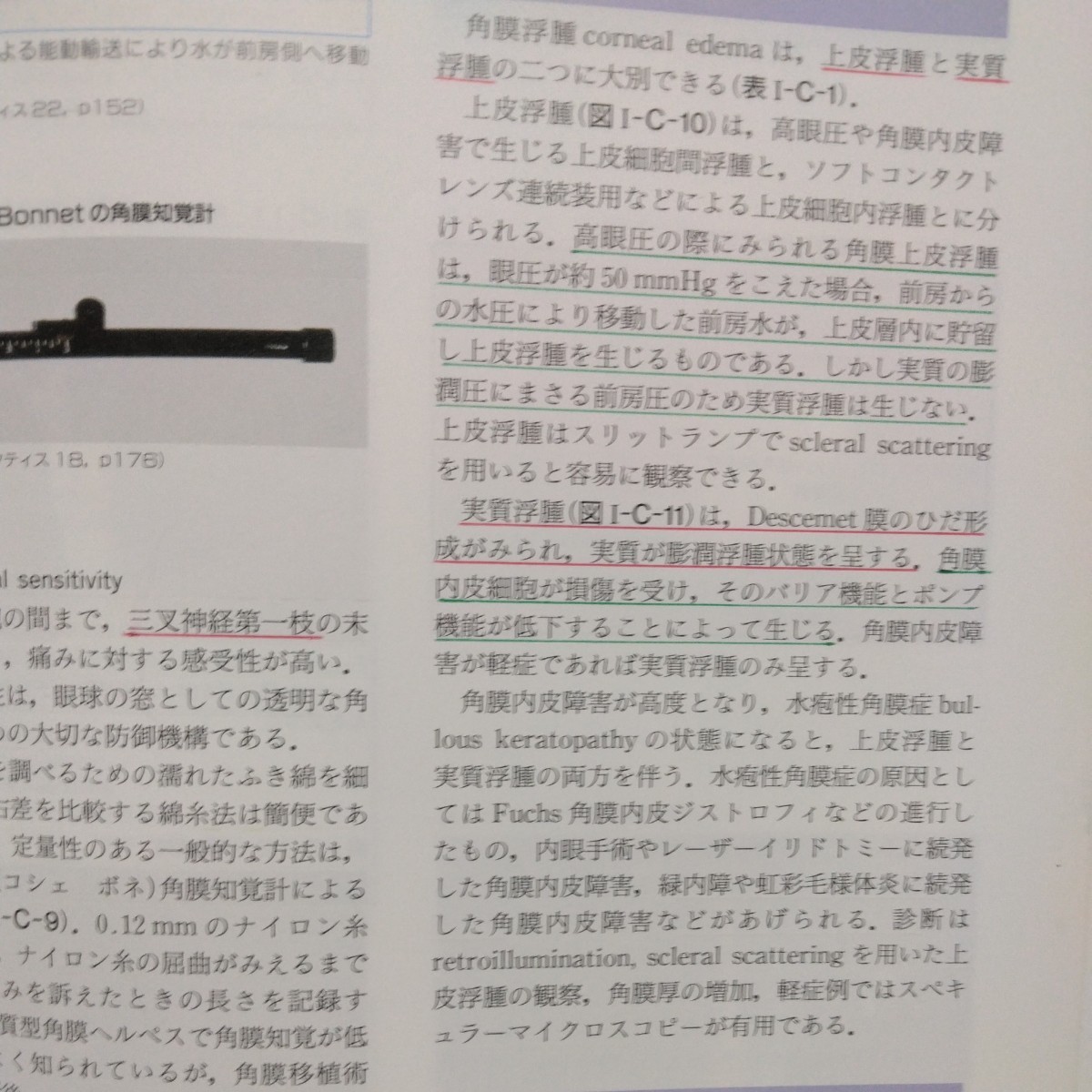 Bibian 比比昂- 眼科学編集丸尾敏夫・本田孔士・臼井正彦・田野 Bibian 比比昂- 眼科学編集丸尾敏夫・本田孔士・臼井正彦・田野