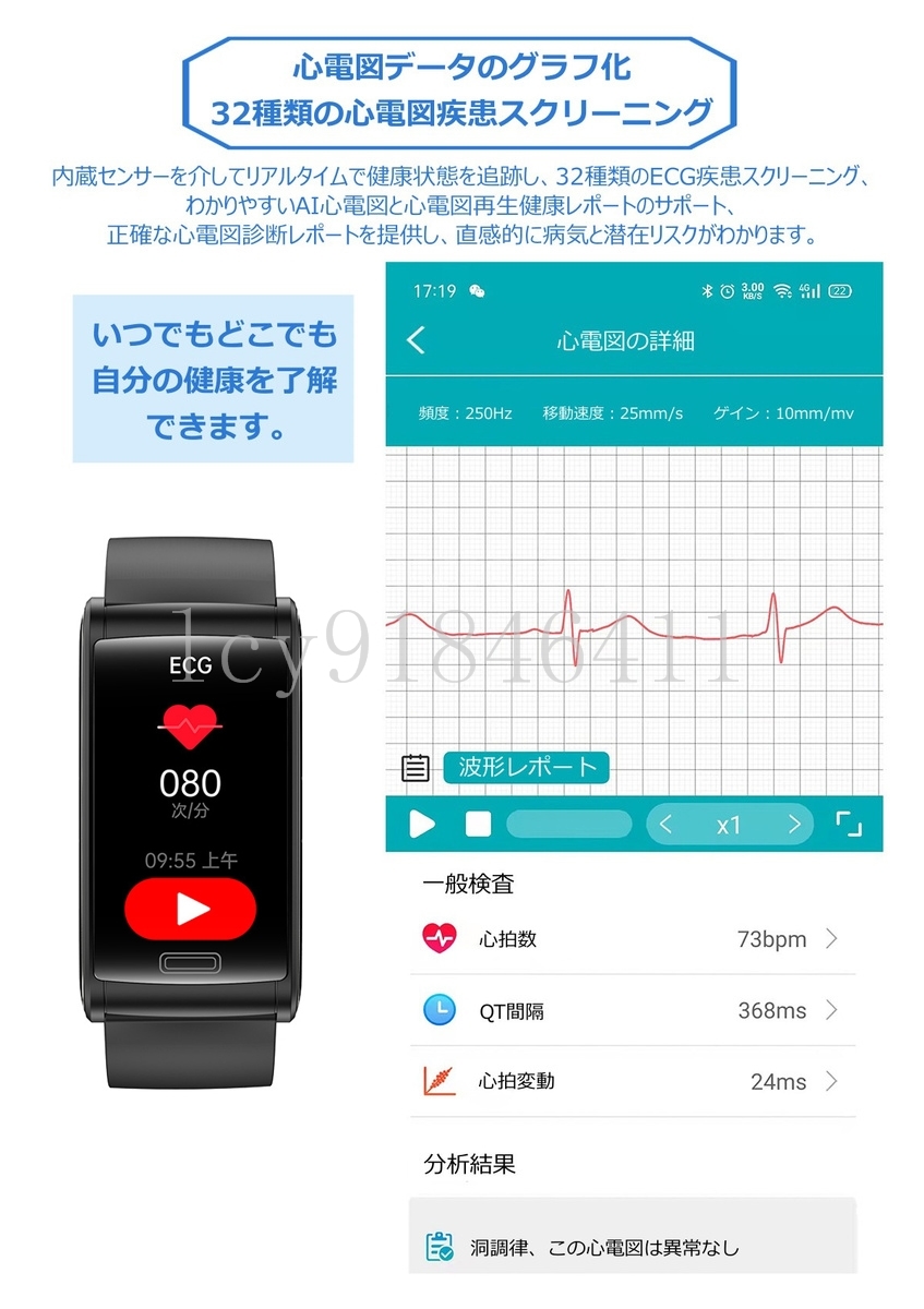  smart watch . sugar price measurement HRV heart . change analysis skin temperature change lady's men's . middle oxygen IP68 waterproof large screen Heart rate monitor sleeping inspection .iphone,Android