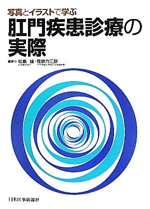 写真とイラストで学ぶ肛門疾患診療の実際／松島誠，佐原力三郎【編】_画像1