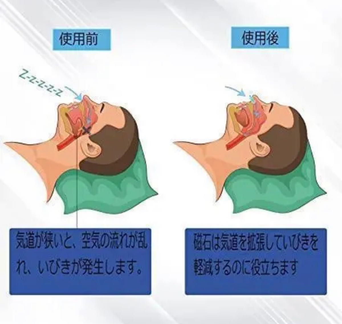 いびき防止 4個 ノーズクリップ 睡眠グッズ いびき対策 シリコン ケース 安眠