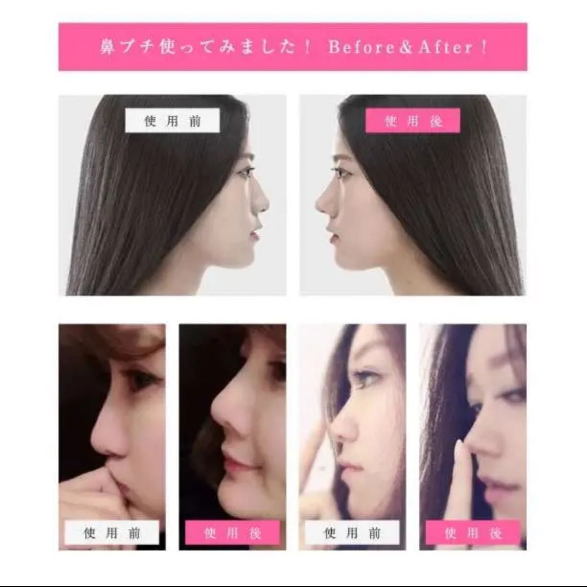 鼻プチ 3サイズセット ノーズアップ 矯正 整形 矯正 鼻高美人 小顔効果 韓国 通販