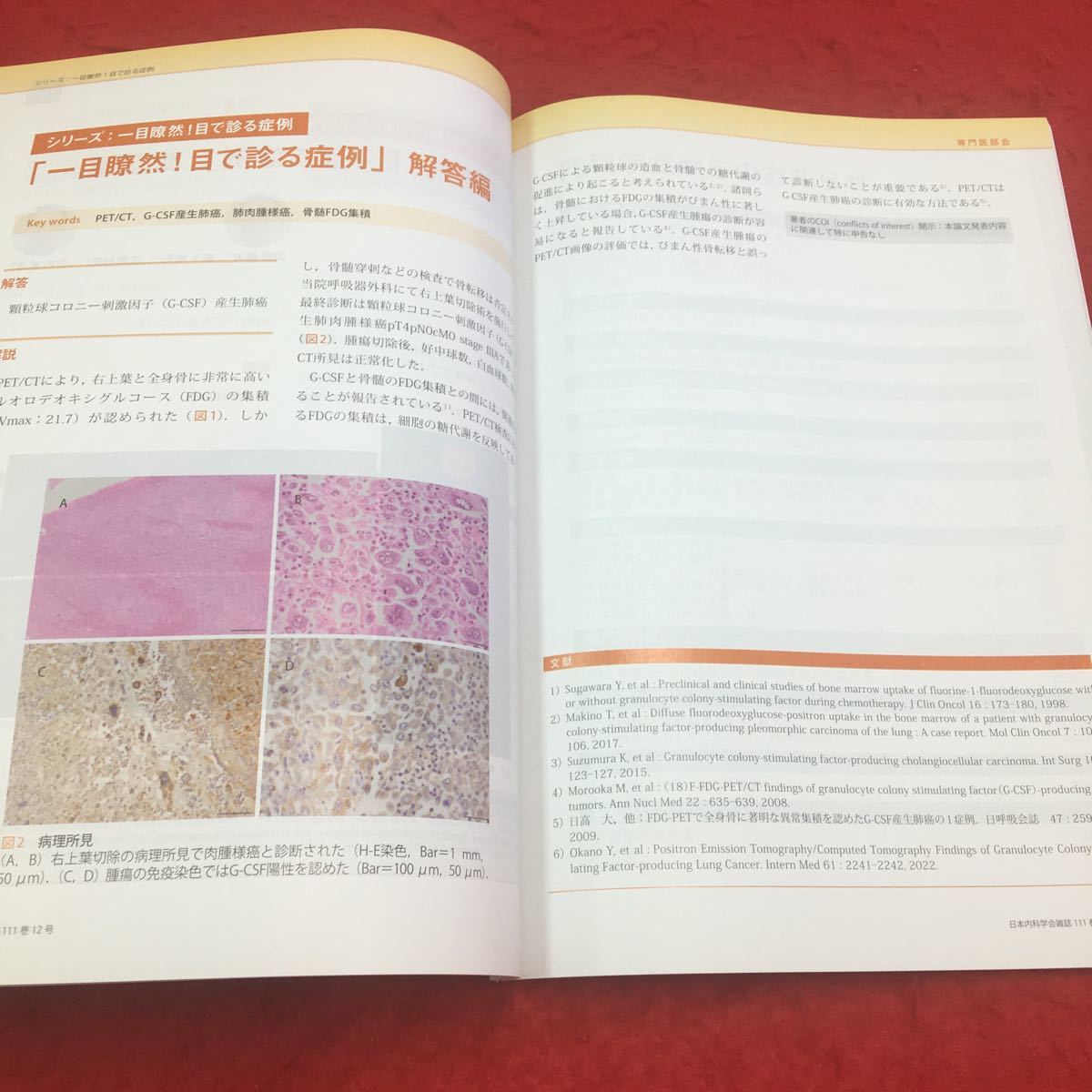 M6a-148 日本内科学会雑誌 第111巻第12号 2022年12月10日発行 特集:内科医が知っておくべき在宅診療のクリニカルパール 日本内科学会_画像4