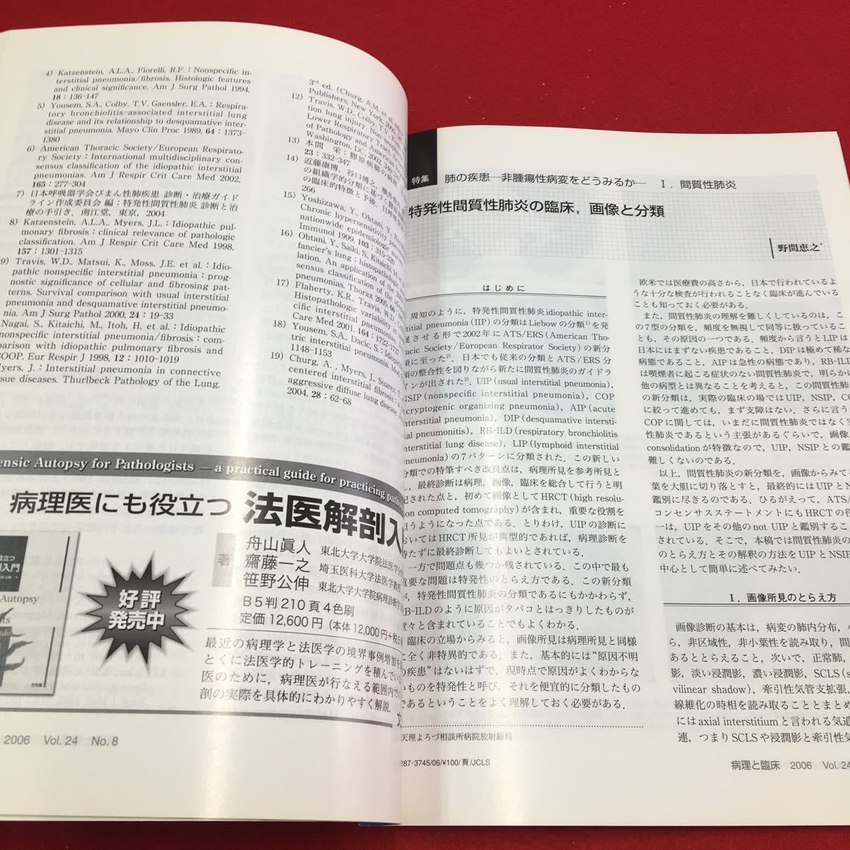 M6a-283 病理と臨床 2006年8月号 特集:肺の疾患 非腫瘍性病変をどうみるか I.間質性肺炎 医学 医療 病理学 臨床学 診断 治療 文光堂_画像4