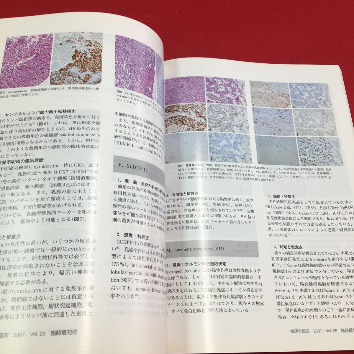 M6a-284 病理と臨床 2007年3月12日臨時増刊号 Vol.25 診断に役立つ免疫組織化学 医学 医療 病理学 臨床学 診断 治療 免疫 文光堂_画像5