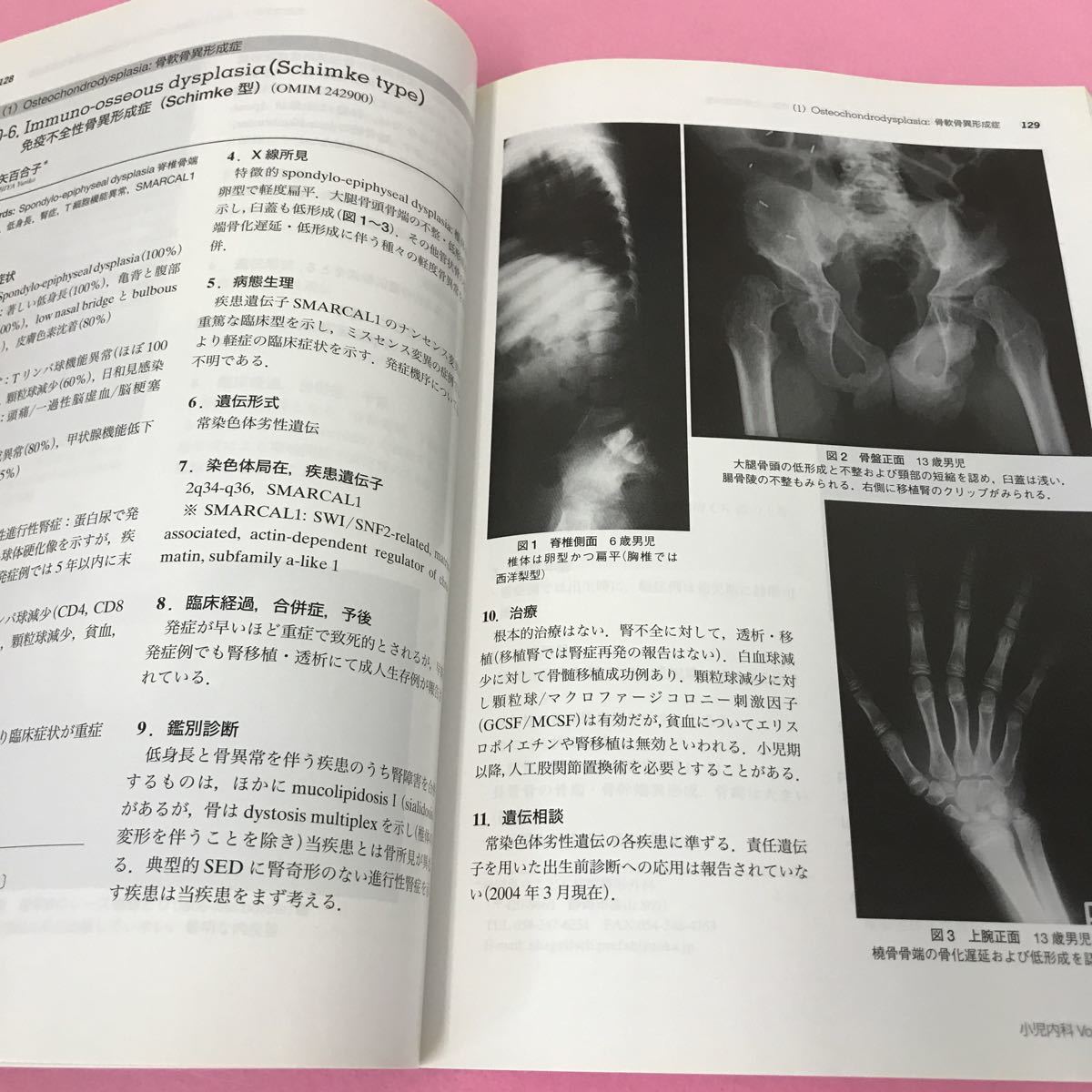 B08-096 小児内科 目でみる骨系統疾患2004 東京医学社 _画像3