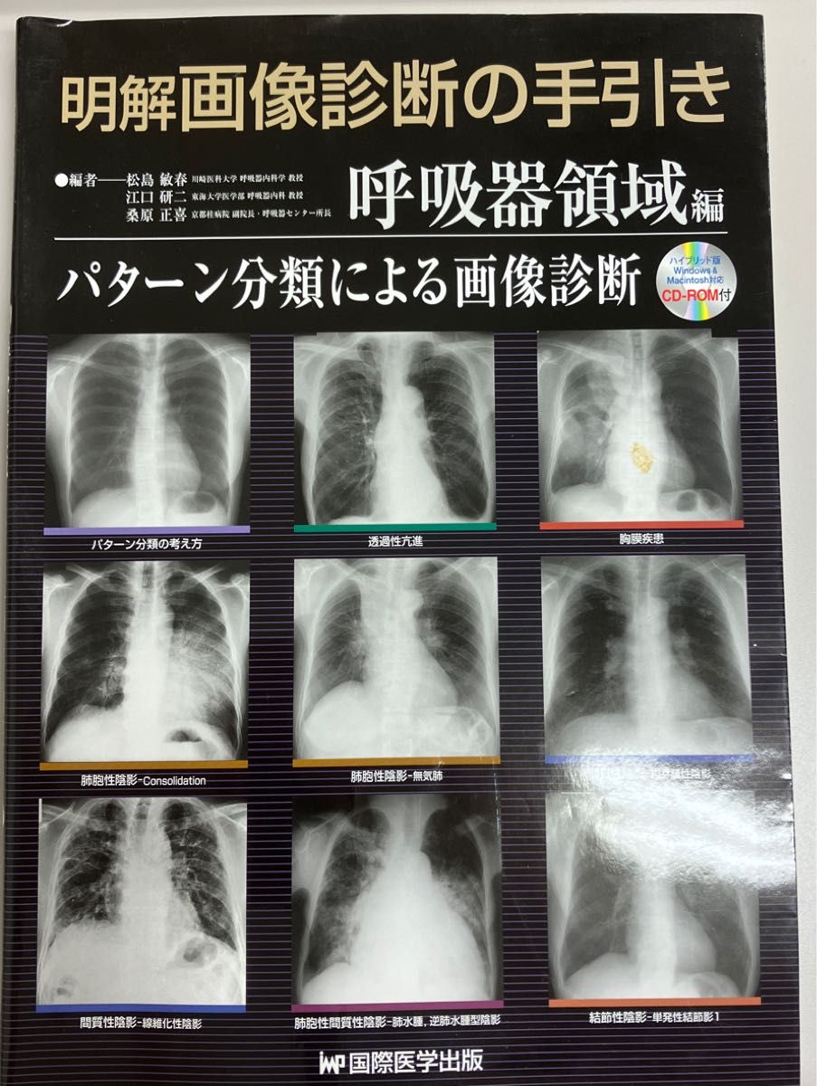 明解　画像診断の手引き　呼吸器領域編