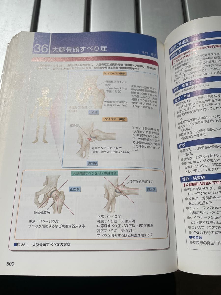 小児看護学　関連図　看護過程　看護計画　国家試験　看護学生　医療　小児