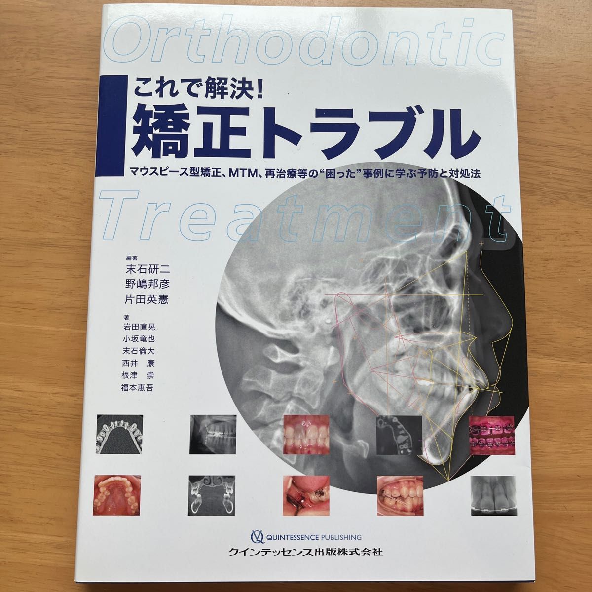 これで解決! 矯正トラブル マウスピース型矯正、MTM、再治療等の これで解決! 矯正トラブル マウスピース型矯正、MTM、再治療等の