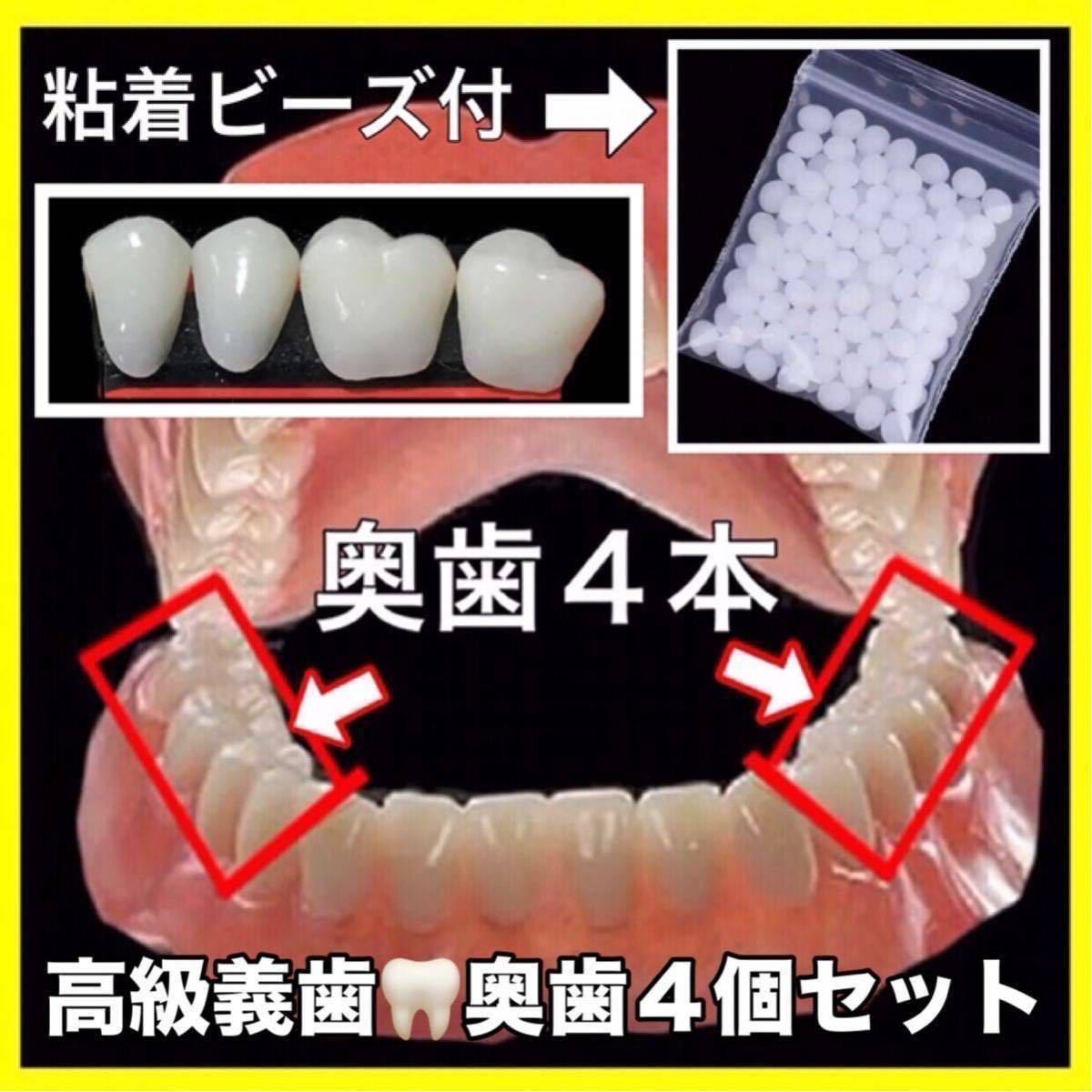 付け歯 つけ歯 入れ歯 矯正 ホワイトニング 上下セット 義歯 歯 マウスピース