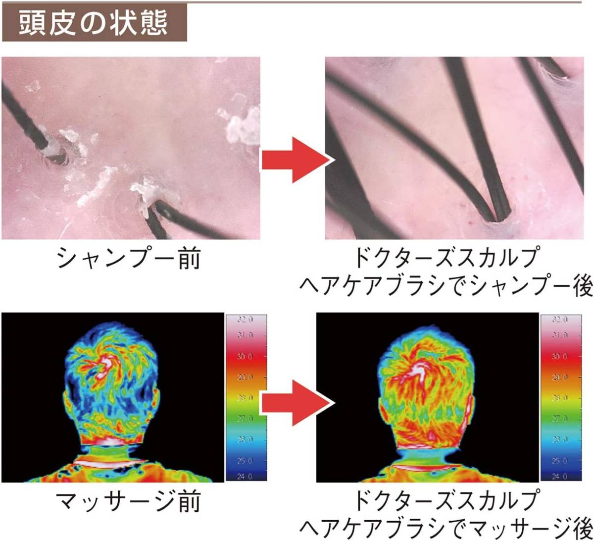 スカルプケアブラシ ヘアブラシ スタイリング ブラック ラウンド 育毛 植毛 頭皮ケア くし ヘアセット マッサージ ブラシ サラツヤ髪復活_画像1