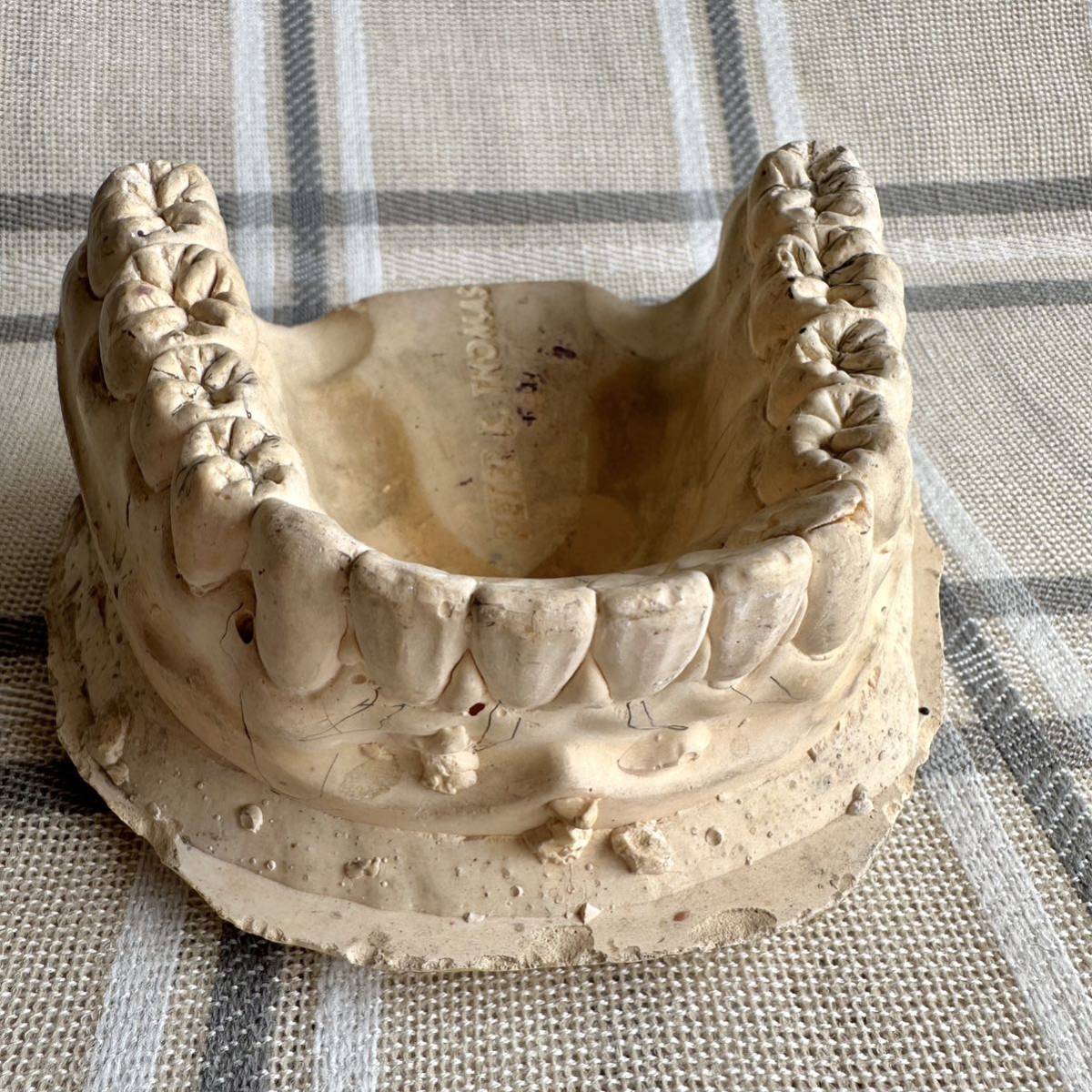 歯型　歯科用石膏　歯医者　DESIGN PETER K. THOMAS D.D.S 2個セット　型取り 歯科用モデル　石膏模型 ピーター K トーマス_画像9
