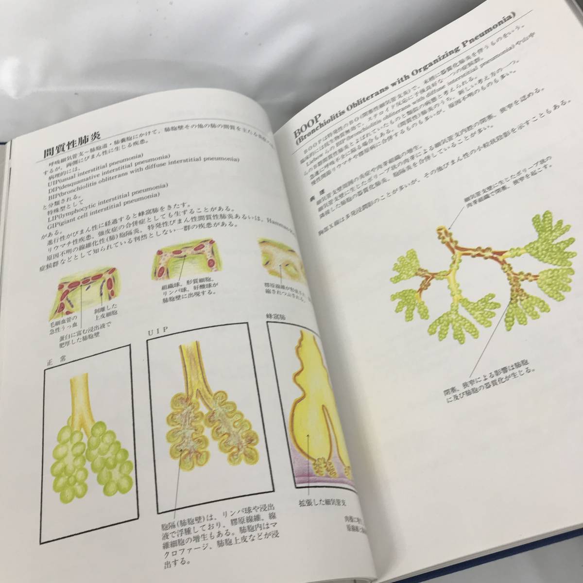 BNC10/59　古本 図解呼吸器 新方式 鑑別診断のために 山本健市著 佐竹辰夫監修 新日本法規 OVER LAY方式 医学本 〇_画像7