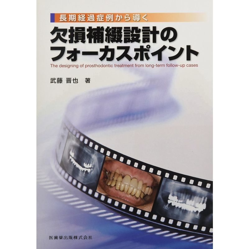 人気が高い 長期経過症例から導く欠損補綴設計のフォーカス