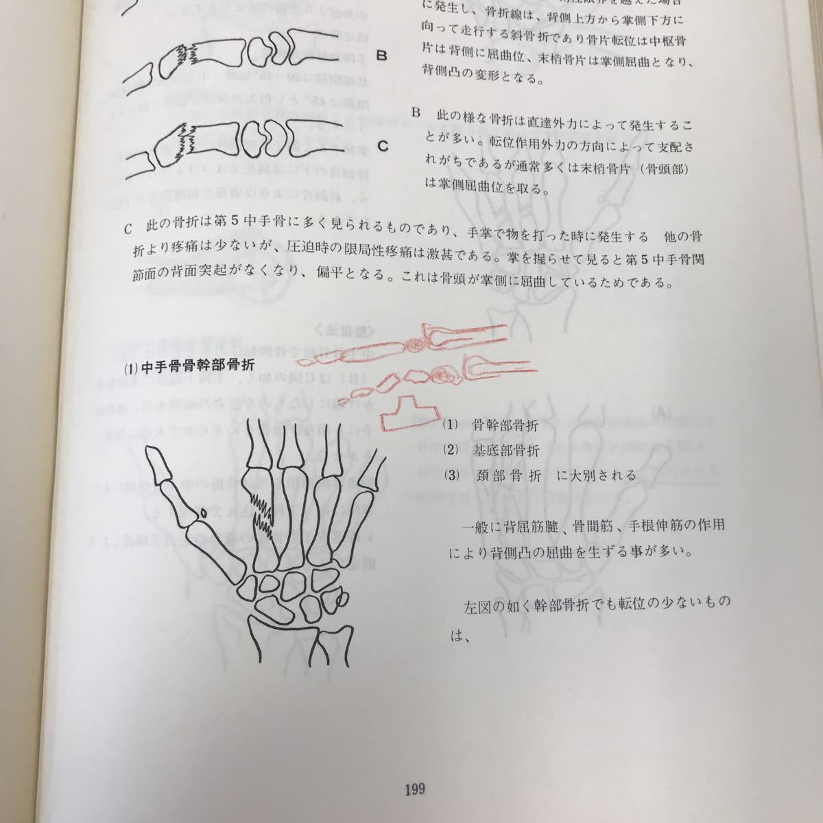 A54-032 整骨学 社団法人 日本柔道整復師会 学術委員会編 書き込み多数有り 背表紙、破れ有り文字が薄くなってます。_画像6