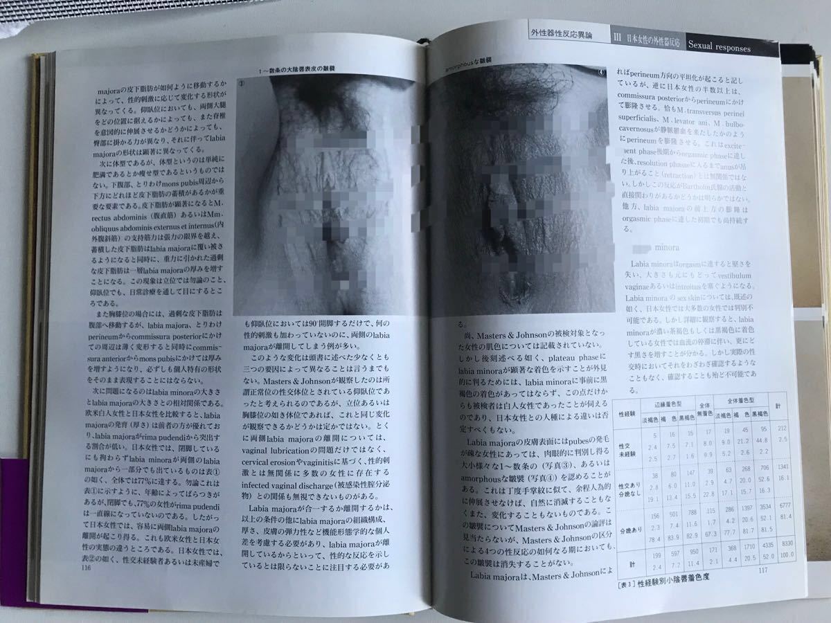 増補改訂版 笠井資料 日本女性の外性器 統計学的形態論-